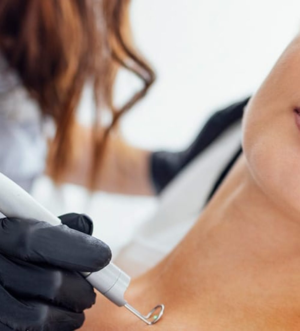 Mole-Treatment Mole-Treatment